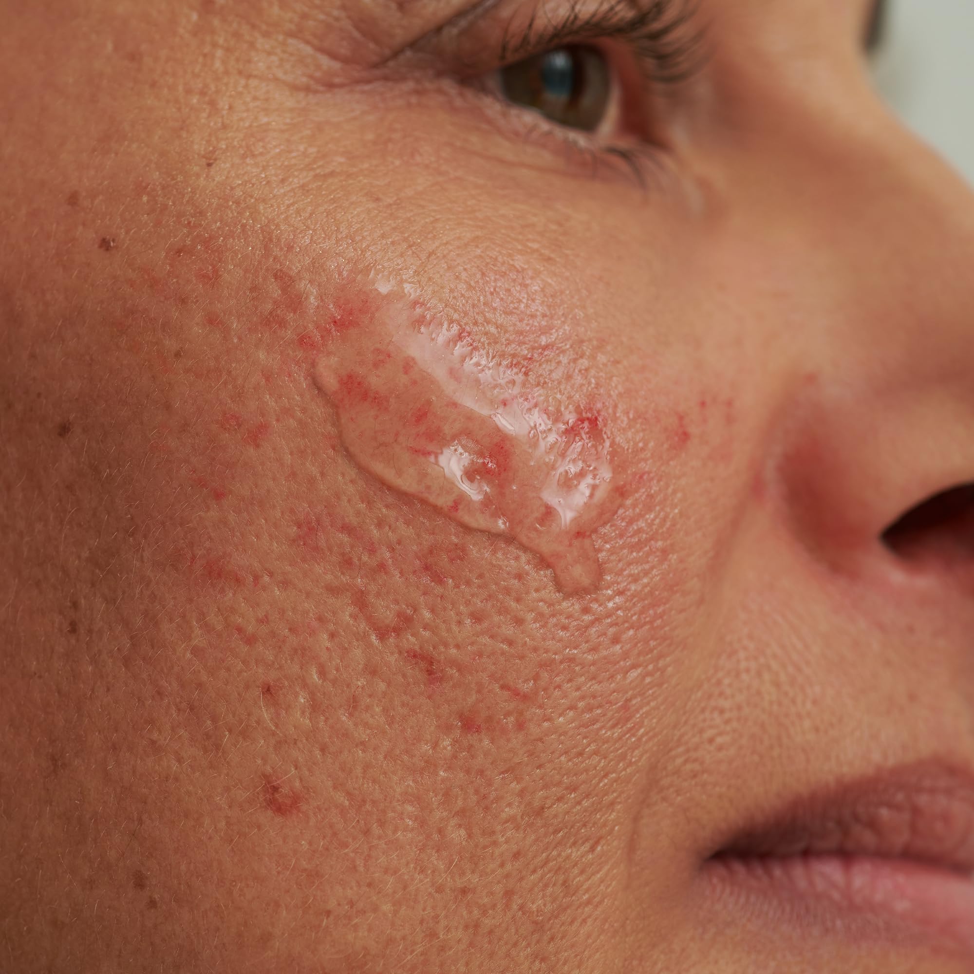 dado-sens-sensacea-reinigungsgel-100-ml-rosacea image 6